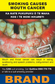 Image of the Smoking causes mouth cancer cigarette packet design - back. 