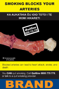 Image of the Blocked Arteries cigarette packet design - back.